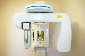 デジタルレントゲン